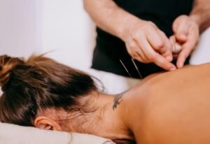 Understanding Dry Needling and It's Benefits
