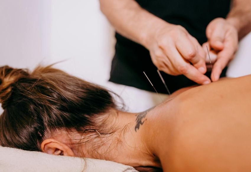 Understanding Dry Needling and It's Benefits