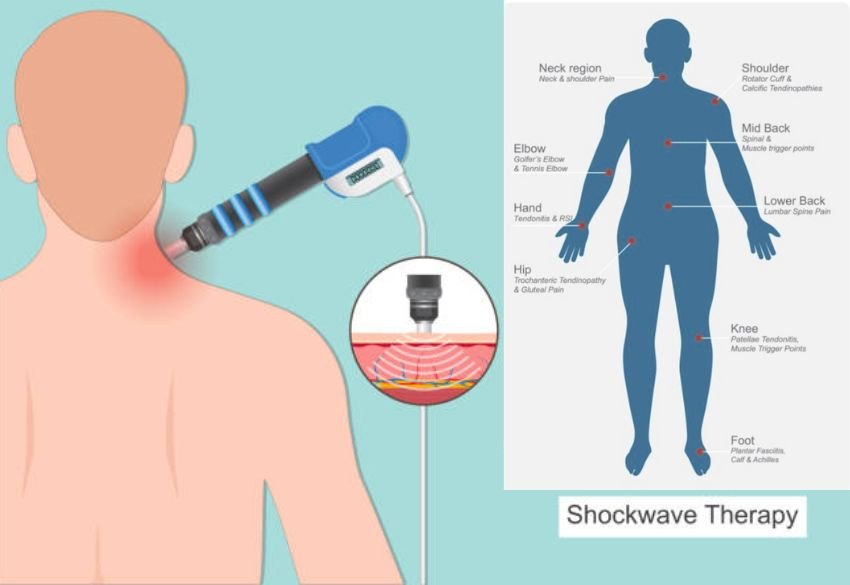 Mickleham Physiotherapy Services featuring How Shockwave Therapy Works